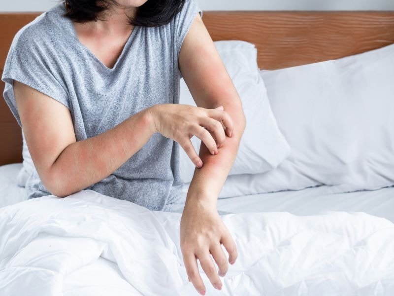 ansiedade causa coceira no corpo mecanismos biológicos